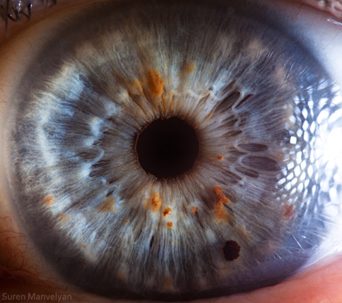 44 Awe-Inspiring Images of the Human Eye